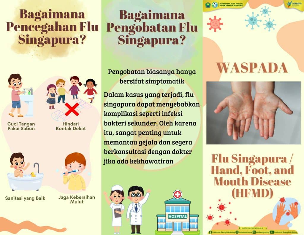 flu singapura